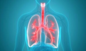 Pulmoner Emboli Nedir?